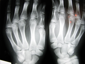 May is Physician Disability Insurance Awareness Month